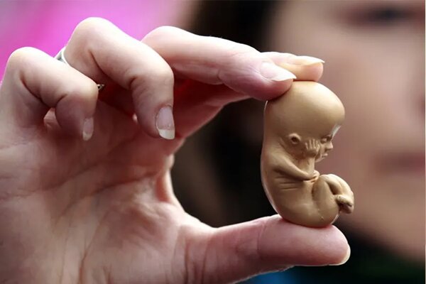 سه ضلع تهدید سلامت جنین و جان مادر سه ضلع تهدید سلامت جنین و جان مادر