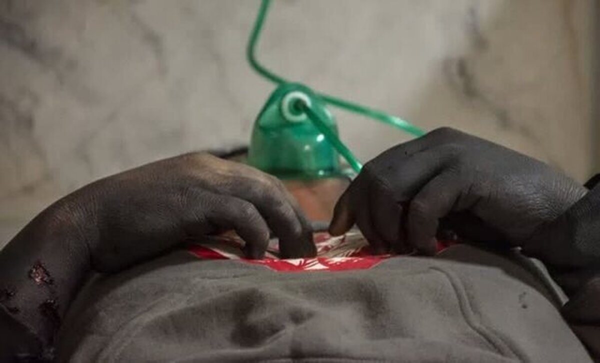 آخرین آمارها مصدومان چهارشنبه سوری اعلام شد آخرین آمارها مصدومان چهارشنبه سوری اعلام شد