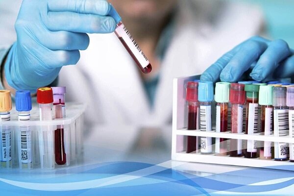 فعالیت ۴۱ آزمایشگاه تشخیص طبی در همدان فعالیت ۴۱ آزمایشگاه تشخیص طبی در همدان